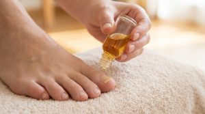 Ongle de pied jaune : causes, solutions et soins naturels